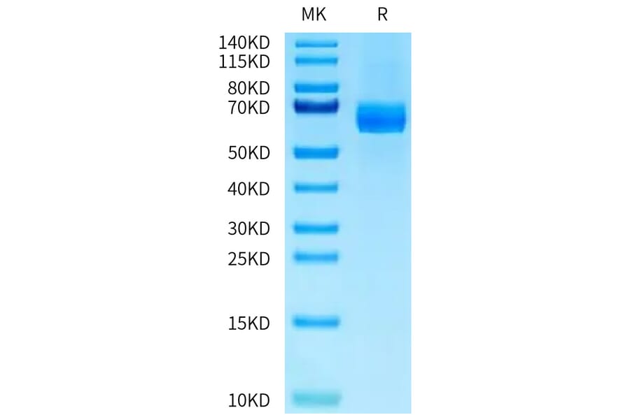 Tris-Bis PAGE - Recombinant Human DLL4 Protein (C-terminal His Tag) (A330540) - Antibodies.com