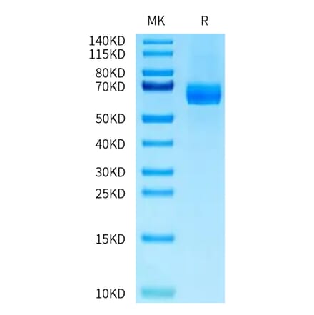 Tris-Bis PAGE - Recombinant Human DLL4 Protein (C-terminal His Tag) (A330540) - Antibodies.com