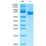 Tris-Bis PAGE - Recombinant Human DLL4 Protein (C-terminal His Tag) (A330540) - Antibodies.com
