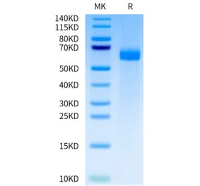 Tris-Bis PAGE - Recombinant Human DLL4 Protein (A330541) - Antibodies.com