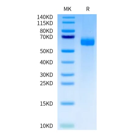 Tris-Bis PAGE - Recombinant Human DLL4 Protein (A330541) - Antibodies.com