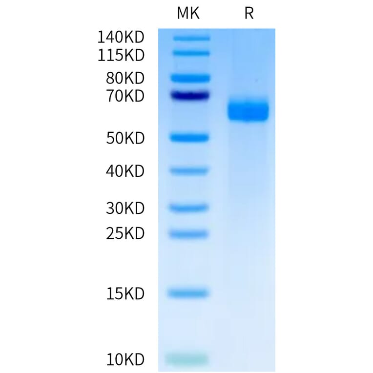 Tris-Bis PAGE - Recombinant Human DLL4 Protein (A330541) - Antibodies.com