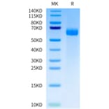 Tris-Bis PAGE - Recombinant Human DLL4 Protein (A330541) - Antibodies.com
