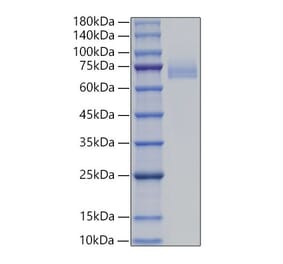 SDS-PAGE - Recombinant Human DLL4 Protein (C-terminal His Tag) (A330542) - Antibodies.com