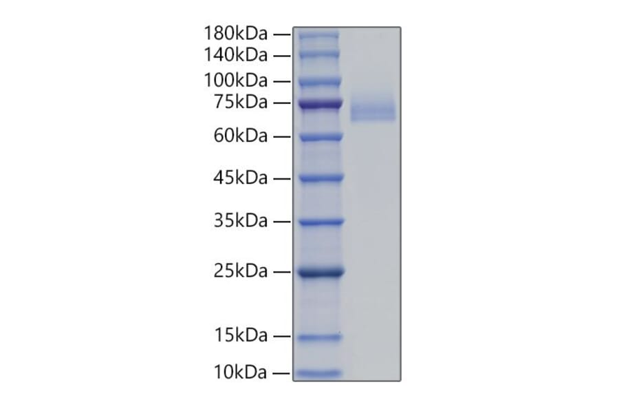 SDS-PAGE - Recombinant Human DLL4 Protein (C-terminal His Tag) (A330542) - Antibodies.com