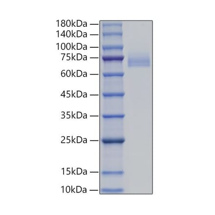 SDS-PAGE - Recombinant Human DLL4 Protein (C-terminal His Tag) (A330542) - Antibodies.com