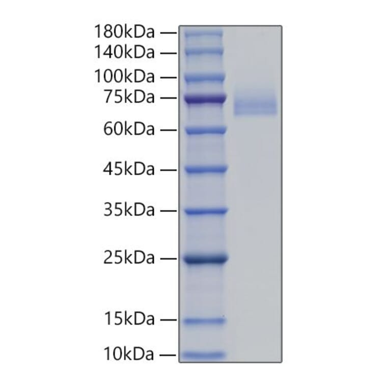 SDS-PAGE - Recombinant Human DLL4 Protein (C-terminal His Tag) (A330542) - Antibodies.com