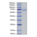 SDS-PAGE - Recombinant Human DLL4 Protein (C-terminal His Tag) (A330542) - Antibodies.com