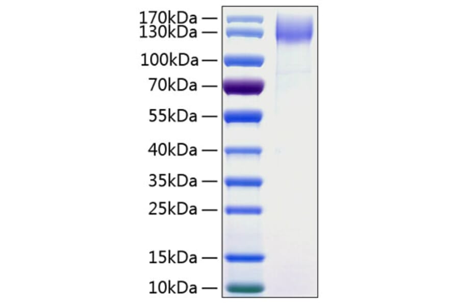 SDS-PAGE - Recombinant Human DNER Protein (C-terminal Human Fc and His Tag) (A330543) - Antibodies.com