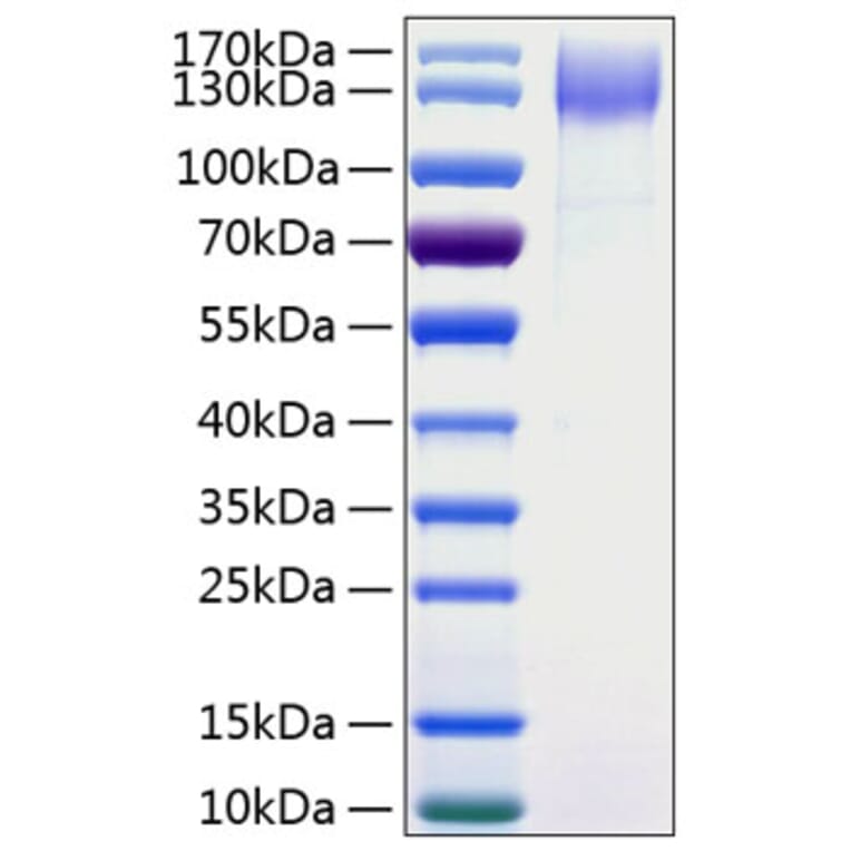 SDS-PAGE - Recombinant Human DNER Protein (C-terminal Human Fc and His Tag) (A330543) - Antibodies.com