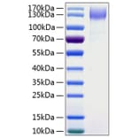 SDS-PAGE - Recombinant Human DNER Protein (C-terminal Human Fc and His Tag) (A330543) - Antibodies.com