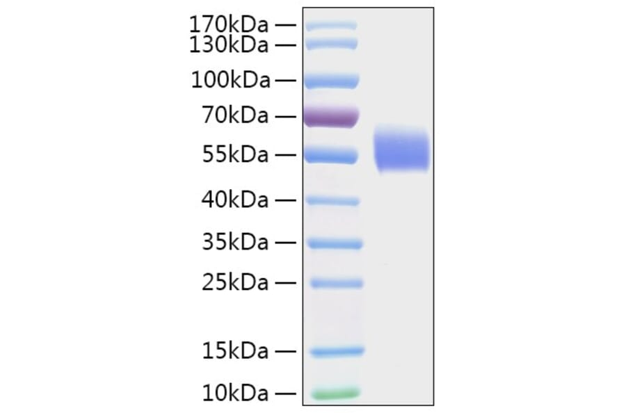 SDS-PAGE - Recombinant Human DPYS Protein (A330544) - Antibodies.com