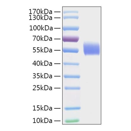 SDS-PAGE - Recombinant Human DPYS Protein (A330544) - Antibodies.com