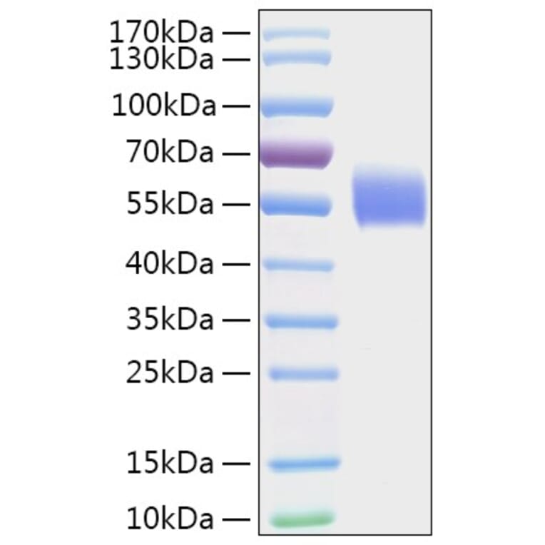 SDS-PAGE - Recombinant Human DPYS Protein (A330544) - Antibodies.com