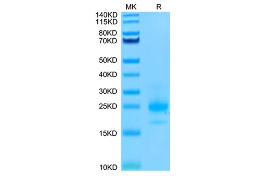 Tris-Bis PAGE - Recombinant Human DR4 Protein (Biotin) (C-terminal His and Avi Tag) (A330546) - Antibodies.com
