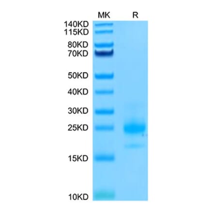 Tris-Bis PAGE - Recombinant Human DR4 Protein (Biotin) (C-terminal His and Avi Tag) (A330546) - Antibodies.com