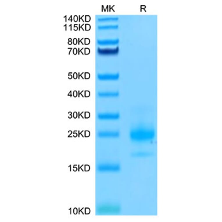 Tris-Bis PAGE - Recombinant Human DR4 Protein (Biotin) (C-terminal His and Avi Tag) (A330546) - Antibodies.com