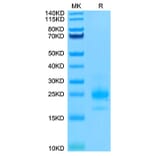 Tris-Bis PAGE - Recombinant Human DR4 Protein (Biotin) (C-terminal His and Avi Tag) (A330546) - Antibodies.com
