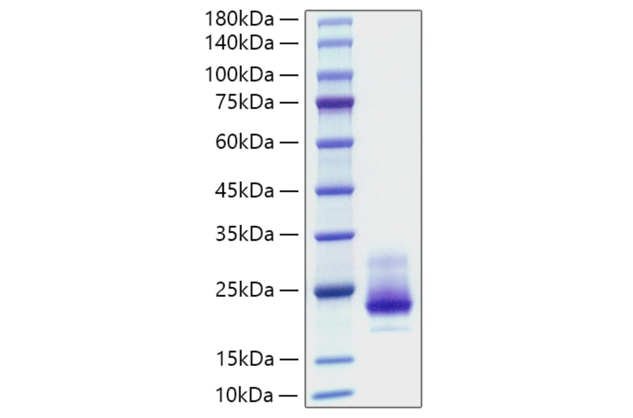 SDS-PAGE - Recombinant Human DR4 Protein (C-terminal His Tag) (A330547) - Antibodies.com