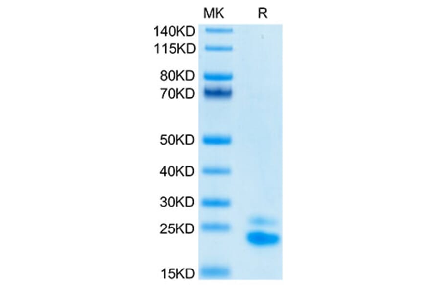 Tris-Bis PAGE - Recombinant Human DR5 Protein (Biotin) (C-terminal His and Avi Tag) (A330548) - Antibodies.com
