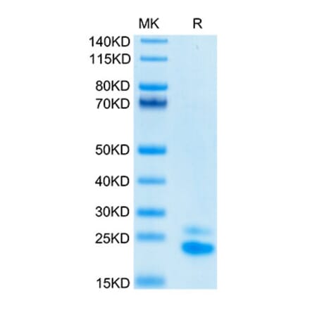 Tris-Bis PAGE - Recombinant Human DR5 Protein (Biotin) (C-terminal His and Avi Tag) (A330548) - Antibodies.com