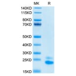 Tris-Bis PAGE - Recombinant Human DR5 Protein (Biotin) (C-terminal His and Avi Tag) (A330548) - Antibodies.com