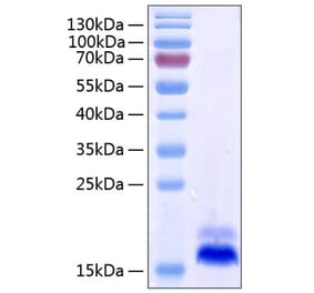 SDS-PAGE - Recombinant Human DR5 Protein (C-terminal His Tag) (A330549) - Antibodies.com