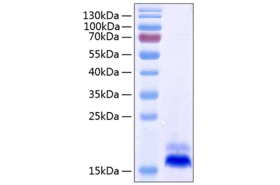 SDS-PAGE - Recombinant Human DR5 Protein (C-terminal His Tag) (A330549) - Antibodies.com