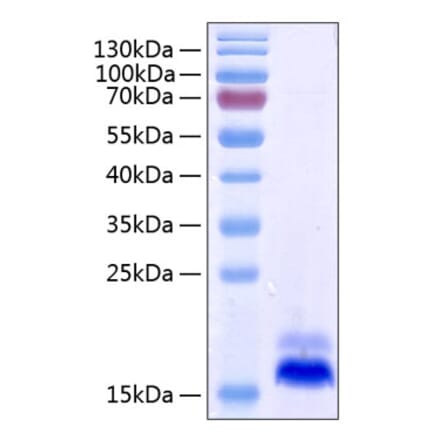 SDS-PAGE - Recombinant Human DR5 Protein (C-terminal His Tag) (A330549) - Antibodies.com
