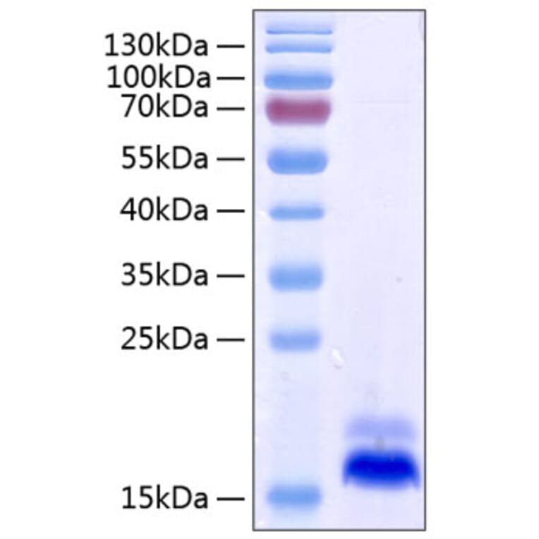 SDS-PAGE - Recombinant Human DR5 Protein (C-terminal His Tag) (A330549) - Antibodies.com
