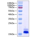 SDS-PAGE - Recombinant Human DR5 Protein (C-terminal His Tag) (A330549) - Antibodies.com