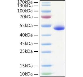 SDS-PAGE - Recombinant Human DR5 Protein (C-terminal Human Fc and His Tag) (A330550) - Antibodies.com