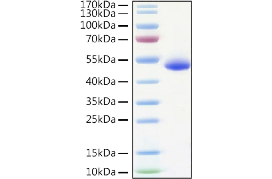 SDS-PAGE - Recombinant Human DR5 Protein (C-terminal Human Fc and His Tag) (A330550) - Antibodies.com