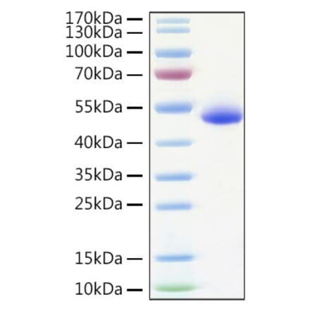 SDS-PAGE - Recombinant Human DR5 Protein (C-terminal Human Fc and His Tag) (A330550) - Antibodies.com