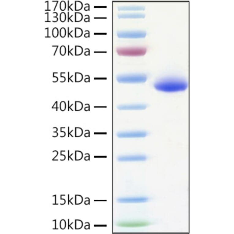 SDS-PAGE - Recombinant Human DR5 Protein (C-terminal Human Fc and His Tag) (A330550) - Antibodies.com