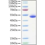 SDS-PAGE - Recombinant Human DR5 Protein (C-terminal Human Fc and His Tag) (A330550) - Antibodies.com