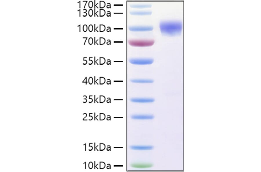 SDS-PAGE - Recombinant Human DR6 Protein (C-terminal Human Fc and His Tag) (A330551) - Antibodies.com