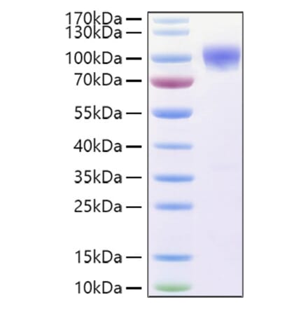SDS-PAGE - Recombinant Human DR6 Protein (C-terminal Human Fc and His Tag) (A330551) - Antibodies.com