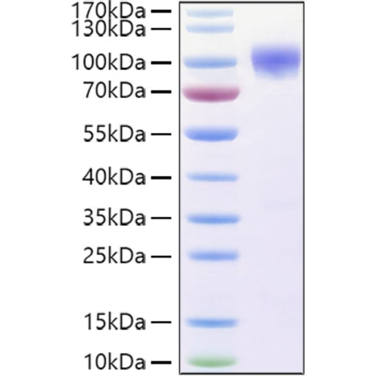 SDS-PAGE - Recombinant Human DR6 Protein (C-terminal Human Fc and His Tag) (A330551) - Antibodies.com