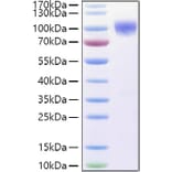 SDS-PAGE - Recombinant Human DR6 Protein (C-terminal Human Fc and His Tag) (A330551) - Antibodies.com