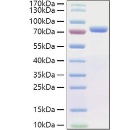 SDS-PAGE - Recombinant Human E Cadherin Protein (C-terminal His Tag) (A330552) - Antibodies.com