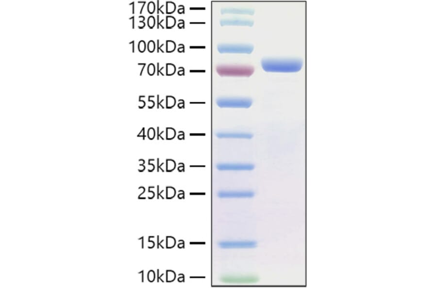 SDS-PAGE - Recombinant Human E Cadherin Protein (C-terminal His Tag) (A330552) - Antibodies.com