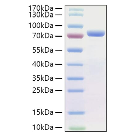 SDS-PAGE - Recombinant Human E Cadherin Protein (C-terminal His Tag) (A330552) - Antibodies.com