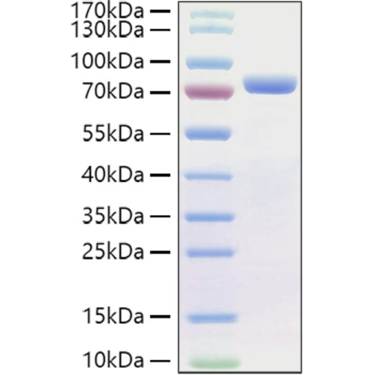 SDS-PAGE - Recombinant Human E Cadherin Protein (C-terminal His Tag) (A330552) - Antibodies.com