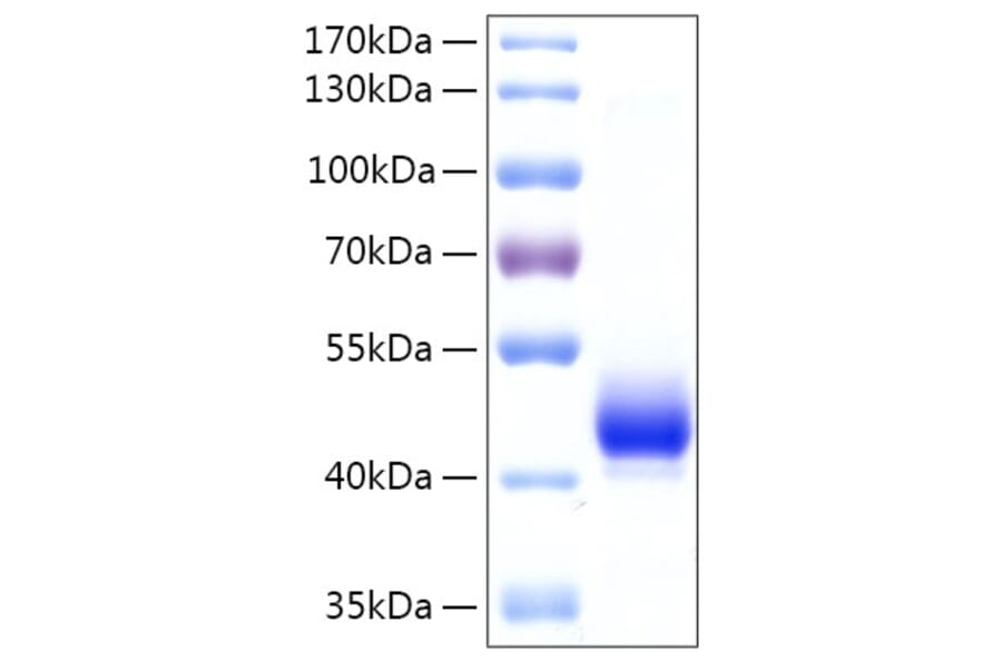 SDS-PAGE - Recombinant Human EBP1 Protein (N-terminal His Tag) (A330553) - Antibodies.com