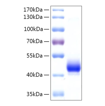 SDS-PAGE - Recombinant Human EBP1 Protein (N-terminal His Tag) (A330553) - Antibodies.com