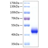 SDS-PAGE - Recombinant Human EBP1 Protein (N-terminal His Tag) (A330553) - Antibodies.com