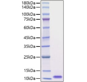 SDS-PAGE - Recombinant Mouse EGF Protein (A330554) - Antibodies.com