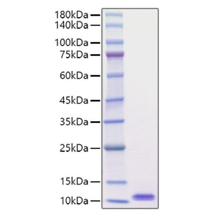 SDS-PAGE - Recombinant Mouse EGF Protein (A330554) - Antibodies.com
