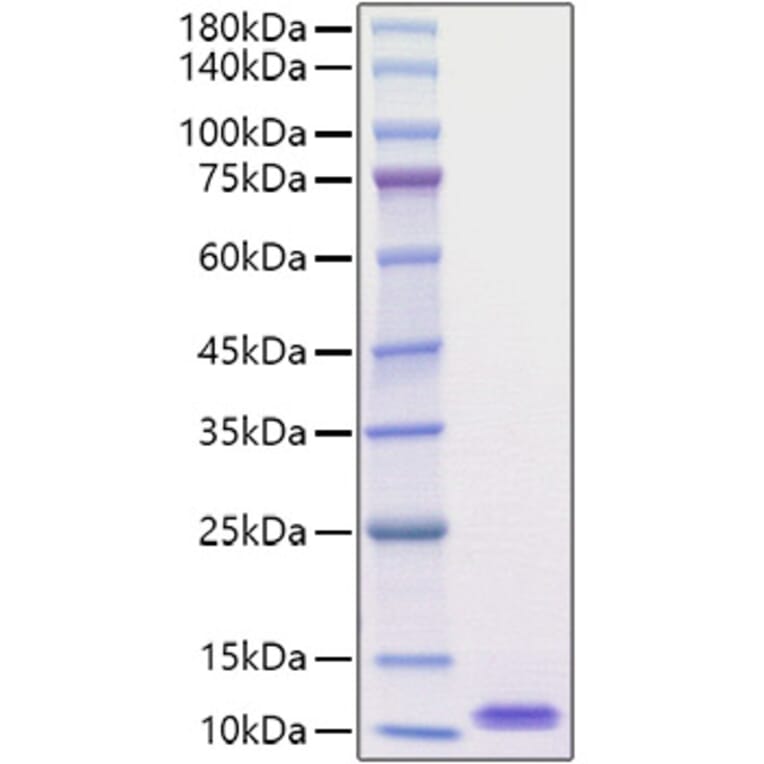 SDS-PAGE - Recombinant Mouse EGF Protein (A330554) - Antibodies.com
